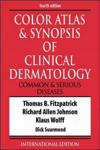 Color Atlas & Synopsis of Clinical Dermatology