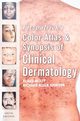 Fitzpatrick's Color Atlas and Synopsis of Clinical Dermatology: Sixth Edition