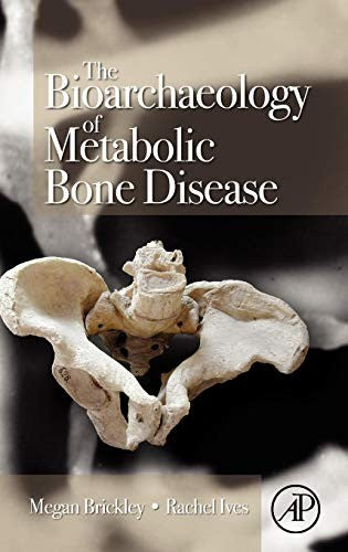 The Bioarchaeology of Metabolic Bone Disease