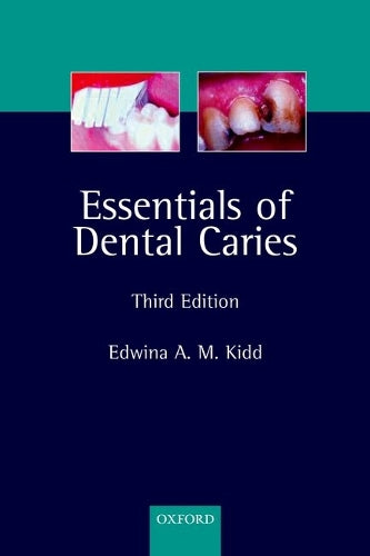 Essentials of Dental Caries