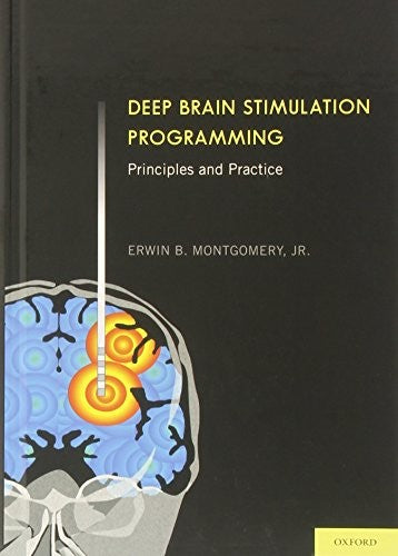 Deep Brain Stimulation Programming