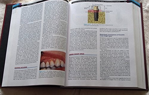 Contemporary Implant Dentistry
