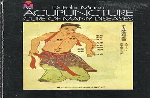 Acupuncture