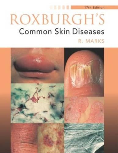 Roxburgh's Common Skin Diseases, 17Ed