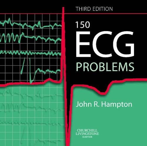 150 ECG Problems