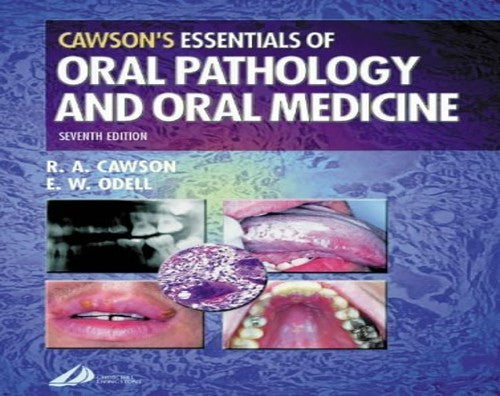 Essentials of Oral Pathology and Oral Medicine
