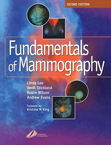 Fundamentals of Mammography