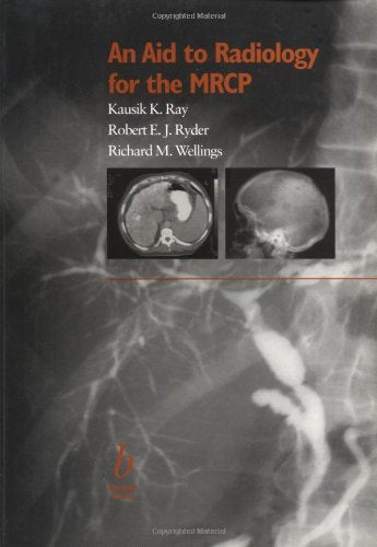 An Aid to Radiology for the MRCP