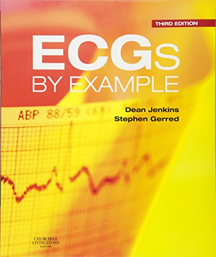 ECGs by Example