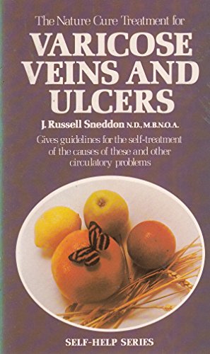 Nature Cure Treatment for Varicose Veins and Ulcers