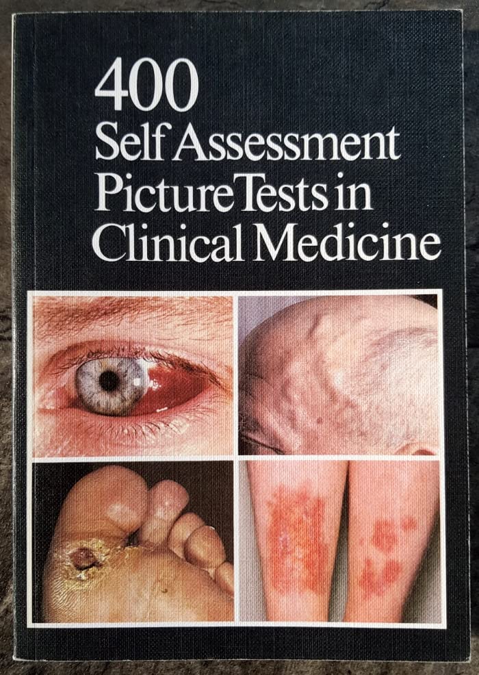 Four Hundred Self-assessment Picture Tests in Clinical Medicine