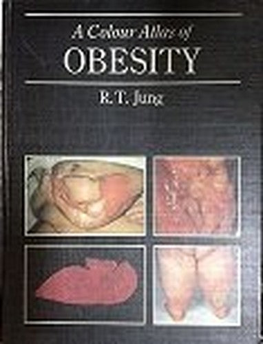 A Colour Atlas of Obesity