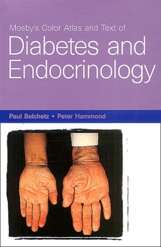 Mosby's Color Atlas and Text of Diabetes and Endocrinology