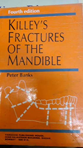 Fractures of the Mandible