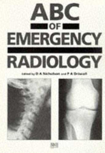 ABC of Emergency Radiology