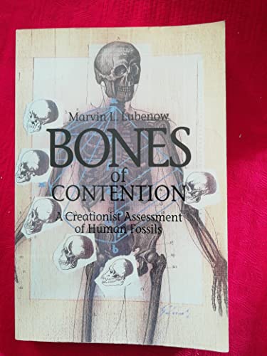 Bones of Contention