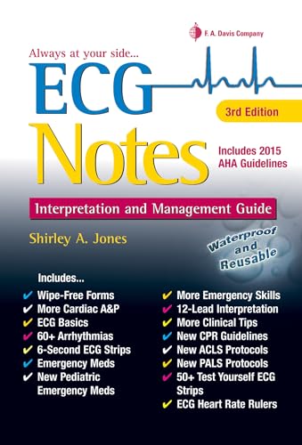 ECG Notes