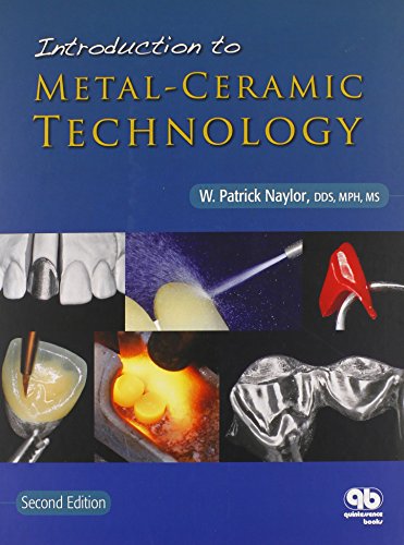Introduction to Metal-ceramic Technology