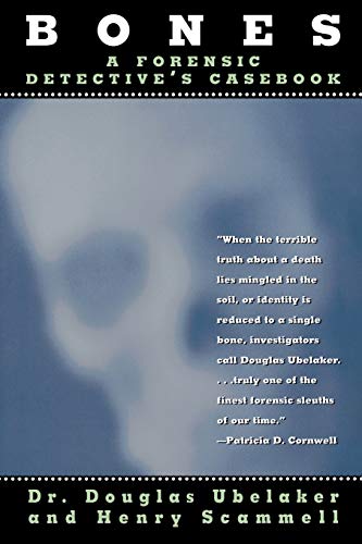 Bones