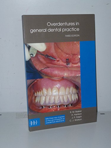 Overdentures in GDP