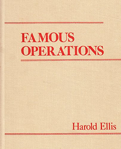 Famous Operations