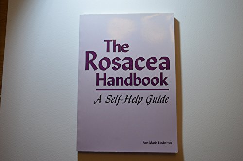 The Rosacea Handbook: A Self-Help Guide