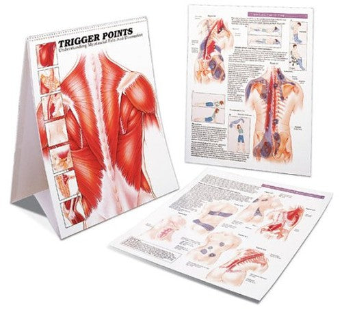 Trigger Points