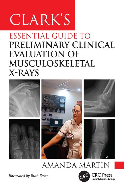 Clarks Essential Guide to Preliminary Clinical Evaluation of Musculoskeletal X-rays