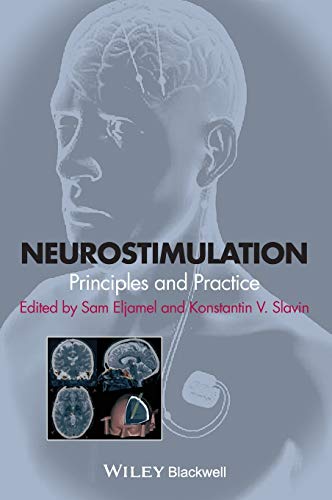 Neurostimulation
