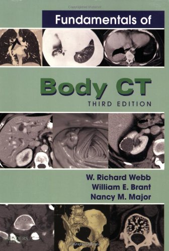 Fundamentals of Body CT