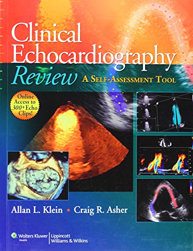 Clinical Echocardiography Review
