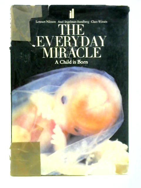The Everyday Miracle: A Child is Born