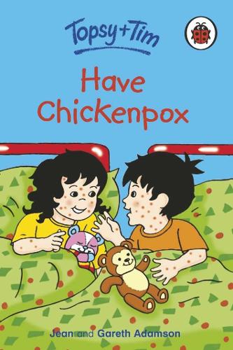 Topsy and Tim: Have Chickenpox