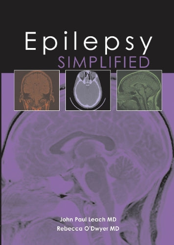 Epilepsy Simplified
