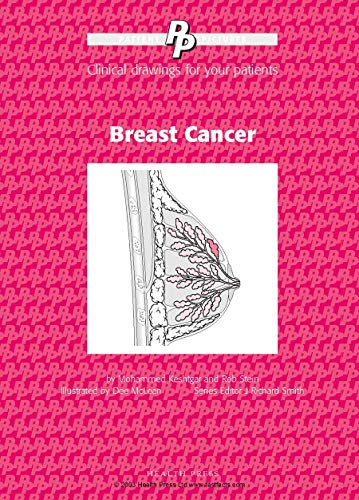 Patient Pictures: Breast Cancer
