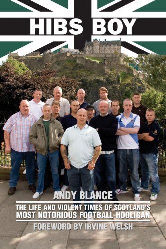 Hibs Boy