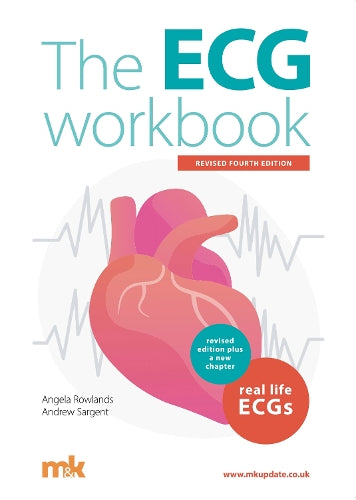 The ECG Workbook