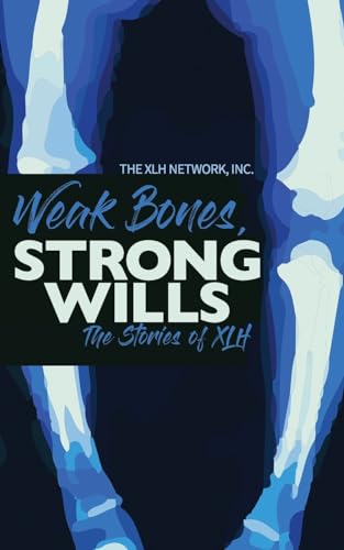 Weak Bones, Strong Wills