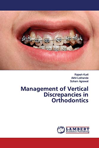 Management of Vertical Discrepancies in Orthodontics