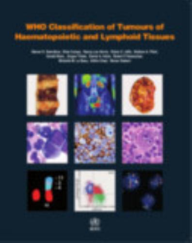 WHO classification of tumours of haematopoietic and lymphoid tissues: Vol. 2