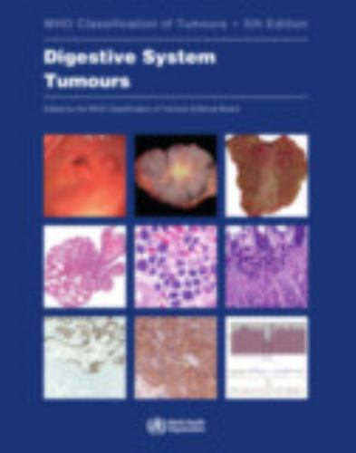 WHO Classification of Tumours. Digestive System Tumours