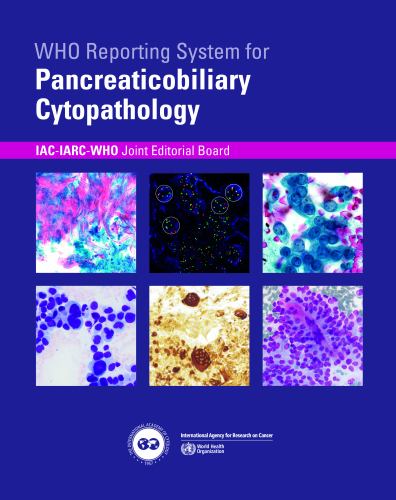 WHO reporting system for Pancreaticobiliary Cytopathology