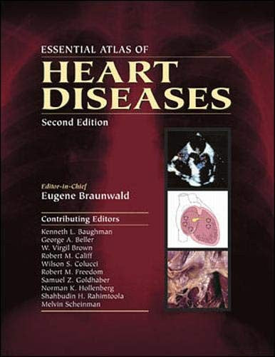 Essential Atlas of Heart Diseases