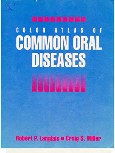 Color Atlas of Common Oral Diseases