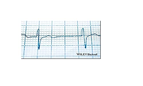 Electrocardiogram in Clinical Medicine