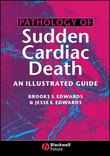 Pathology of Sudden Cardiac Death