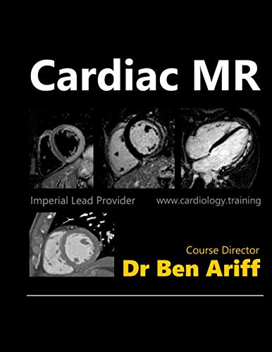 Cardiac MR