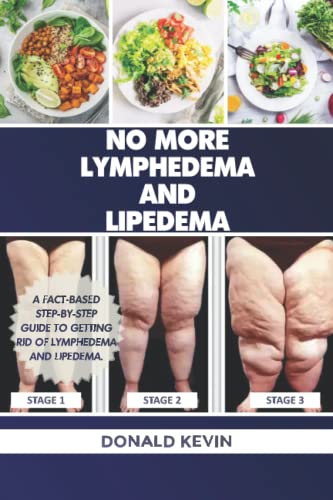 No More Lymphedema and Lipedema: A fact-based step-by-step guide to getting rid of lymphedema and Lipedema.