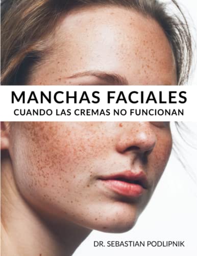 Manchas faciales: Cuándo las cremas no funcionan