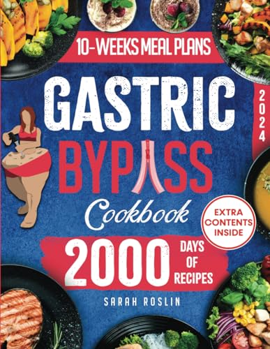 Gastric Bypass Cookbook : Overcome Your Food Addiction and Heavy Past to Rise from the Ashes Through a Meal Plan with Tested, Tasty, and Balanced Recipes Phoenix Bariatric Diet Method